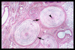 <p>Sensory receptors that respond to heavy pressure.</p>