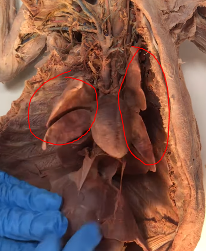 <p>What are these structures</p>