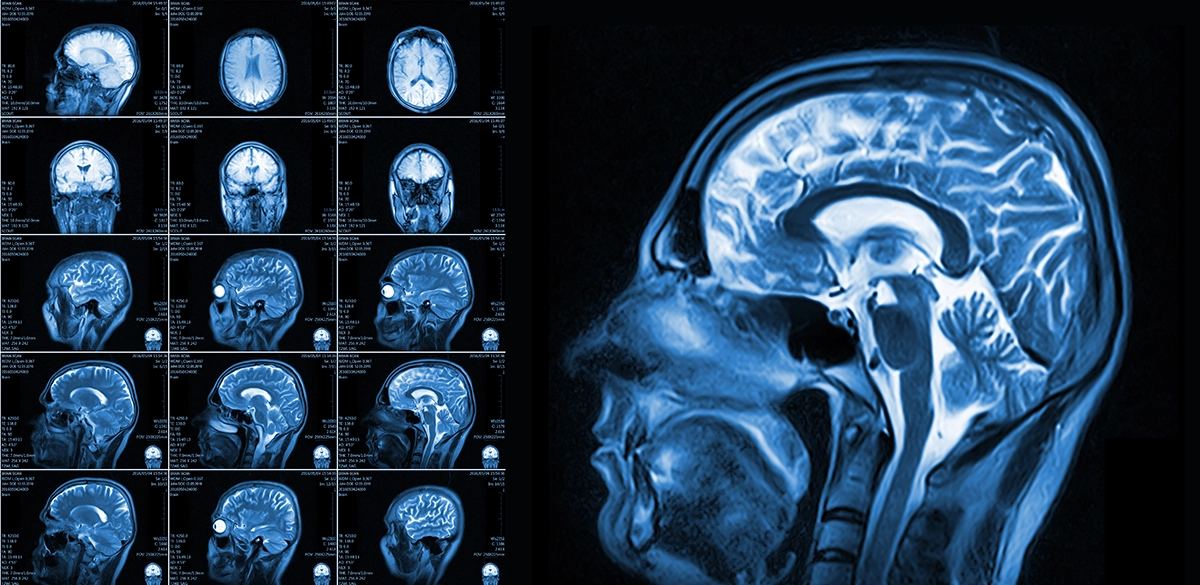 <p>Inventor of 1st MRI? </p>