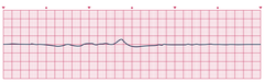 <p>identify the rhythm</p>