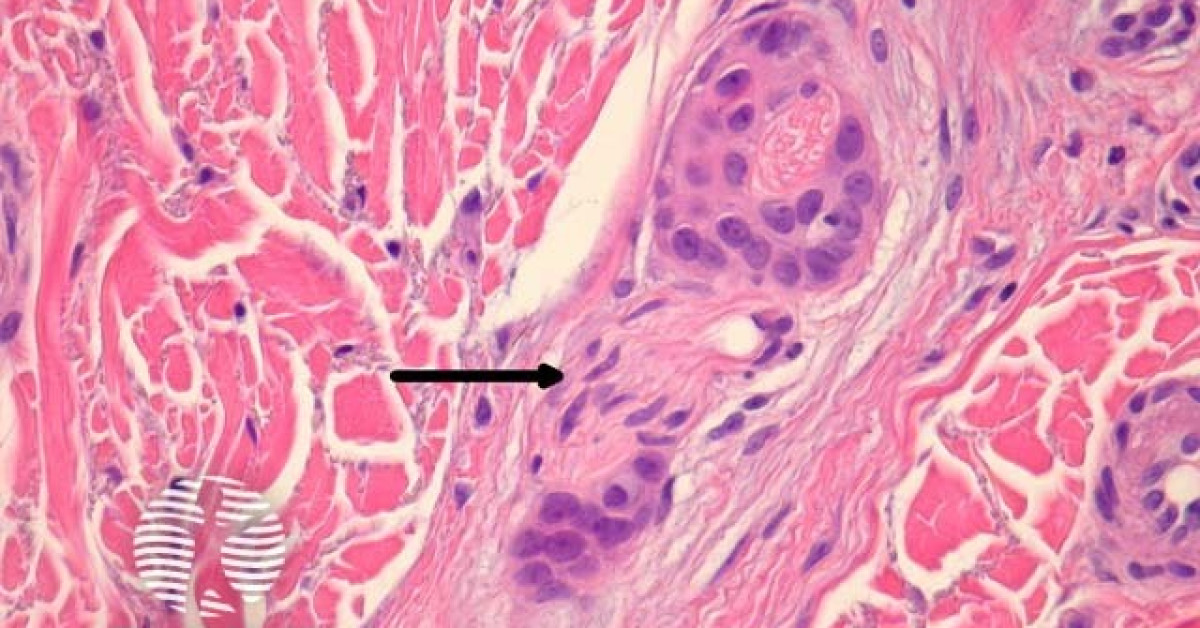 <p>what <strong>shape</strong> of epithelial tissue does this image display?</p>