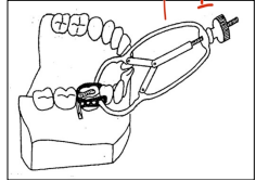 <p>which matrix band is this?</p>