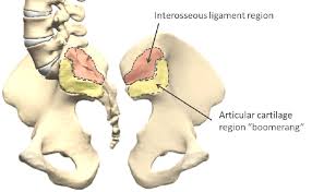 <p>Located on the sacroiliac joint; “boomerang” shape</p>