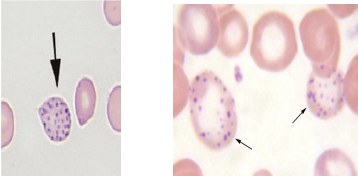 <p>Basophilic Stippling </p>