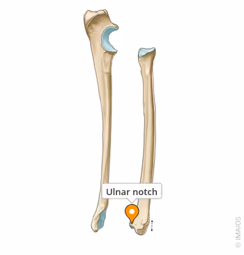 <p>Name the specific part of the bone in color</p>