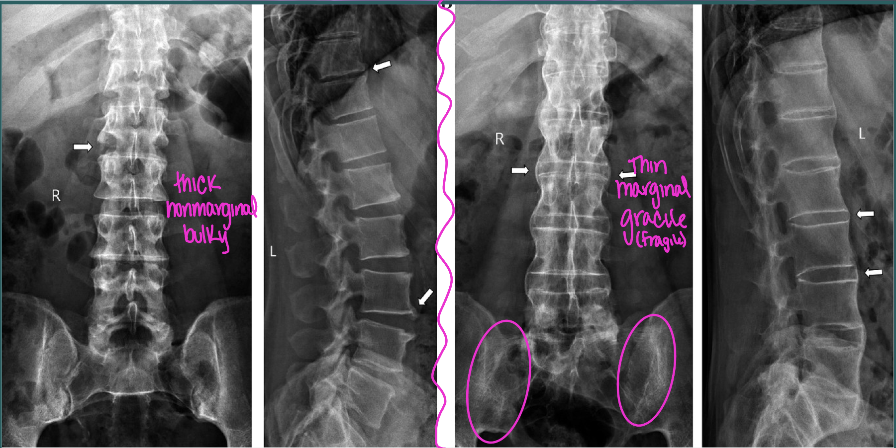 <p>What are the two dx of these images (left vs right)</p>