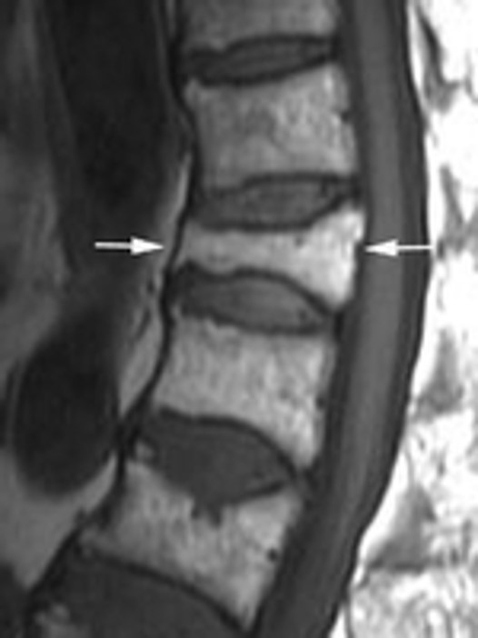 <p>Is this fracture old or new and why?</p>