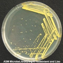 <p>produces bright yellow colonies; most common even in clean rooms</p>