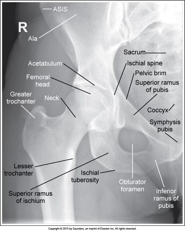 <p>AP hip</p>