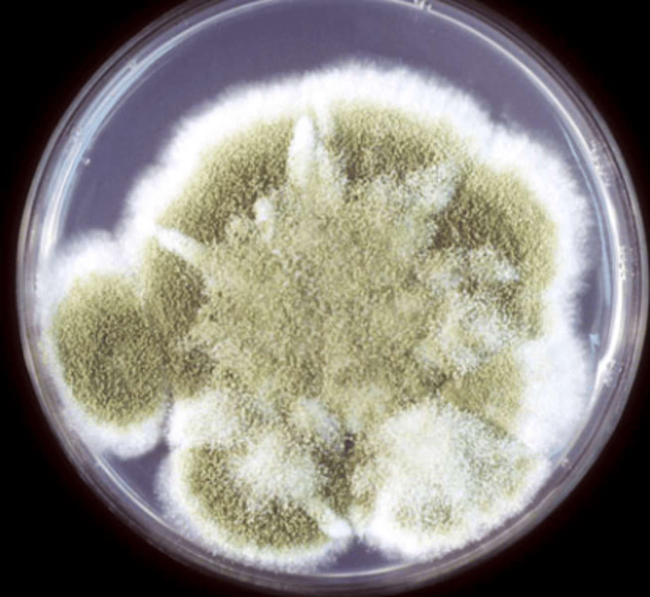 <p>Granular to wooly</p><p>Yellow/brown</p><p>Gold/red/brown reverse</p><p>3-5 days</p>