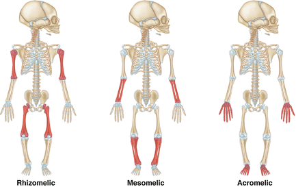 <p>Rhizo-top bones</p><p>meso- middle bones</p><p>micro- small middle and top bones</p><p>acromelic- hands/feet </p>