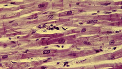 <p>Muscle tissue found in heart. Cells are branched with striations and one nuclei in center</p>