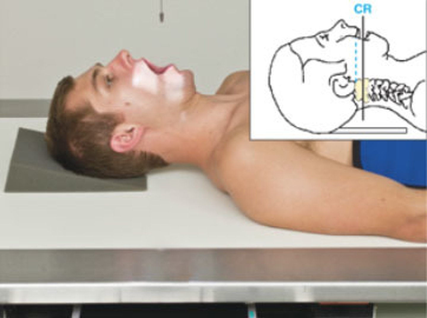 <p>- What is the exam?</p><p>- What is the view used to demonstrate?</p><p>- What is the SID?</p><p>- What is the patient's position?</p><p>- What should the chewing surface of the upper incisors be in line with?</p><p>- Where is the CR directed?</p><p>- What are the breathing instructions?</p><p>- What anatomy should be in the center?</p>