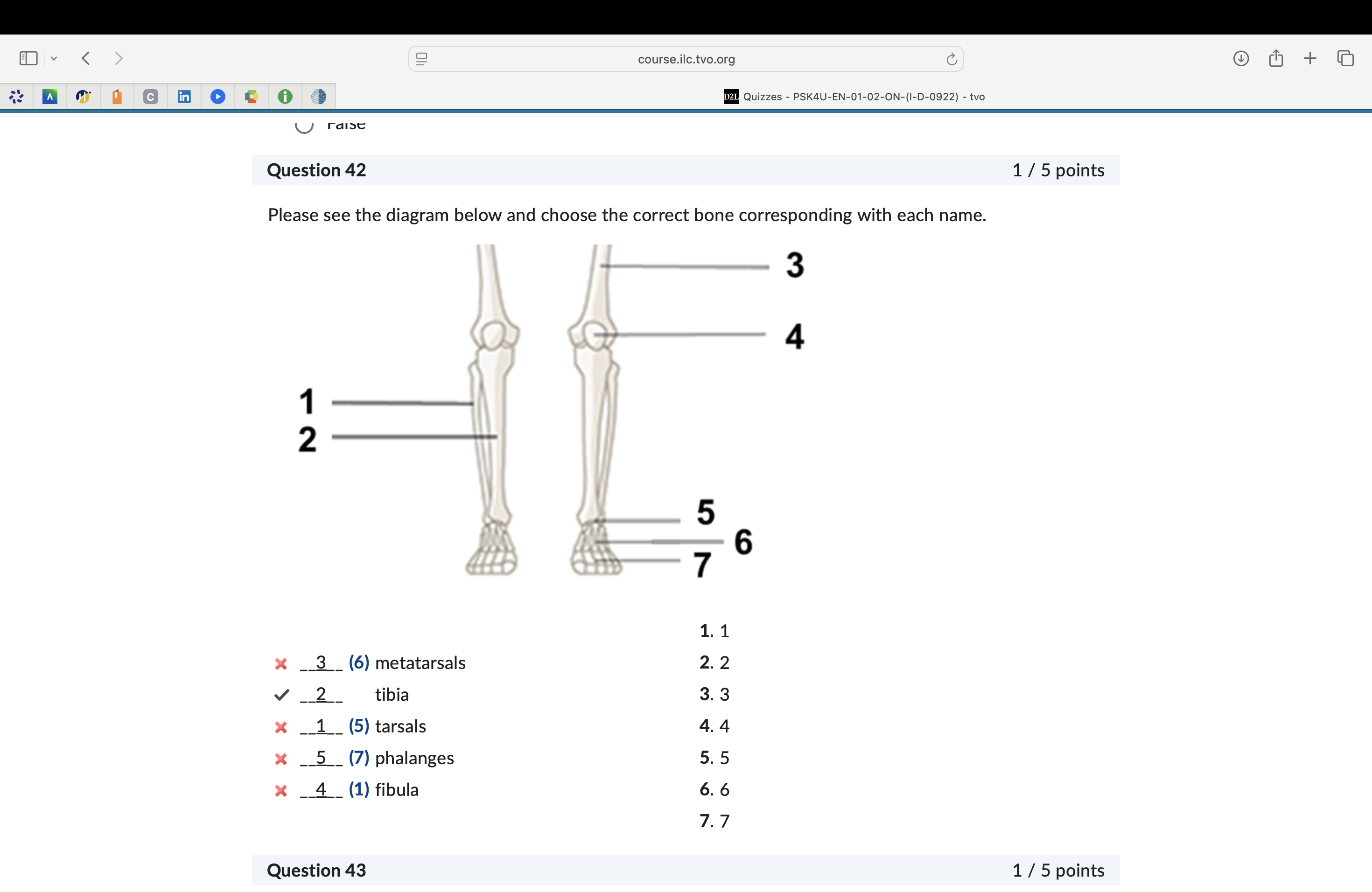 <p>choose the correct bone corresponding with each name</p>