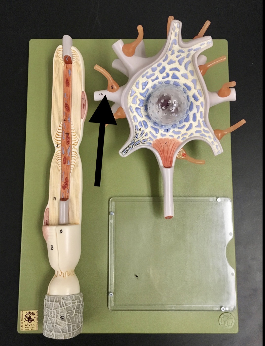 <p>What is the arrow pointing to?</p>