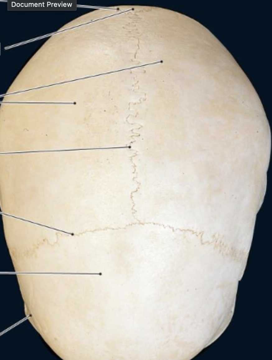 <p>suture separating occipital and parietal </p>