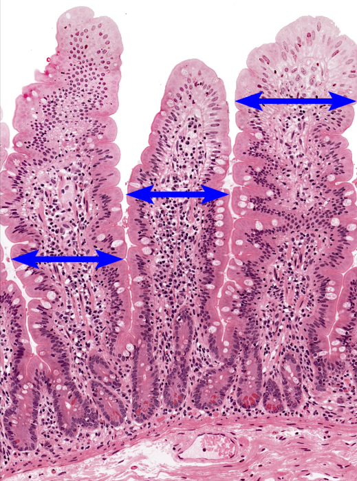 <p>Small Intestine</p><p><strong>NOTICE: THE FINGER-LIKE PROJECTIONS (VILLI) WITH OPEN SPACE INSIDE AND A FEW GRAY/BLUE GOBLET CELLS ALONG THE SIDES (NOT AS MANY AS LARGE INTESTINE</strong></p>
