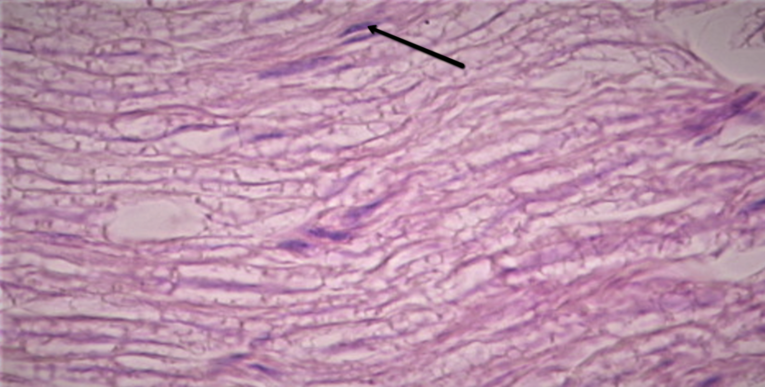 <p><span><strong>Identify the flat dark structure at the tip of the pointer.</strong></span></p>