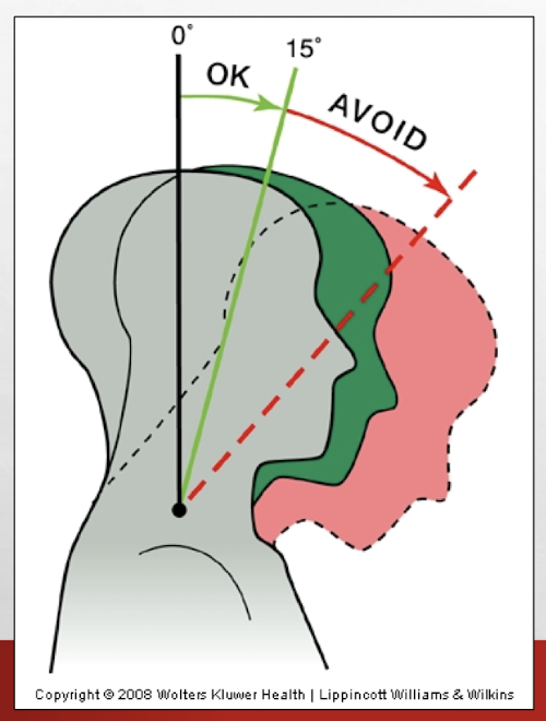<p>Head tips too far forward or tilted to one side</p>
