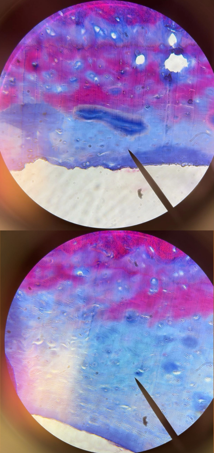 <p>tissue</p>
