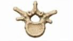 <p>vertebrae, sacrum, coccyx, sphenoid bone, ethmoid bone, many facial bones</p>