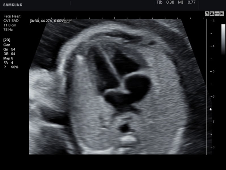 <p>normal or abnormal</p>