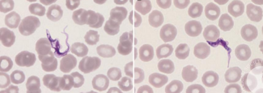 <p>What microorganism appears as this?</p>