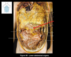 <p>What structure is the red arrow pointing to?</p>