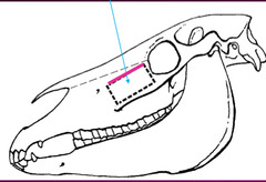 <p>When doing surgery of the sinuses, what is this approach? What do the lines mean?</p>