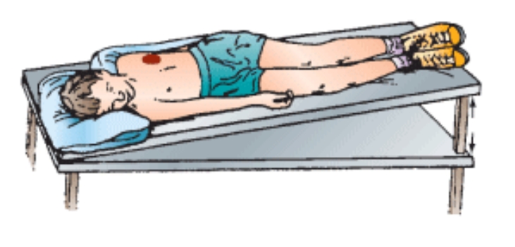 <p>Lingula </p><p>Client in right side-lying position, rotated one-quarter turn backwards, head of bed tipped down 15 degrees (Trendelenburg position)</p>