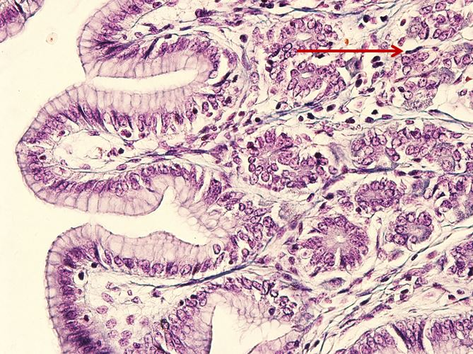 <p>Tế bào gì ?</p>