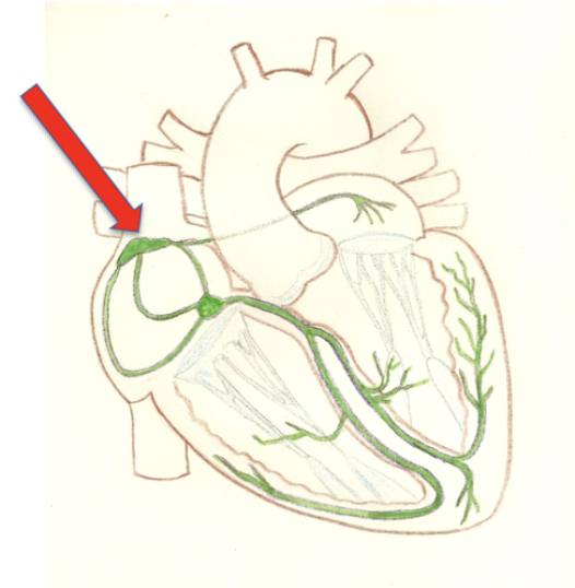 <p>Located in the right atrial wall and is known as the heart’s pacemaker</p>