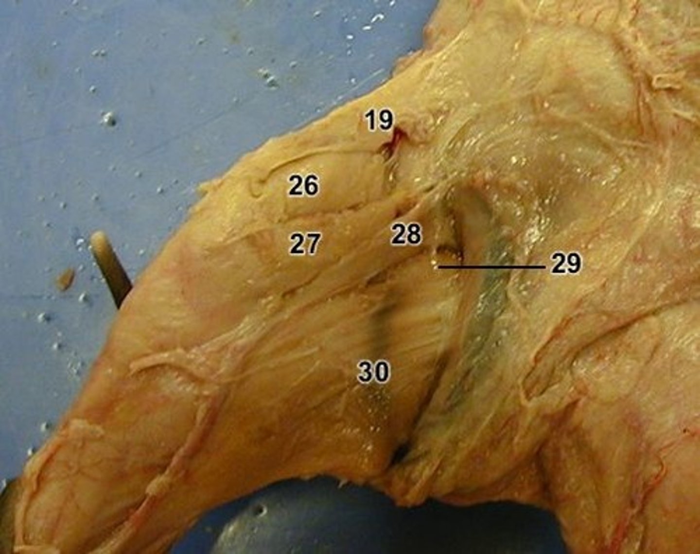 <p>19 = ?</p>