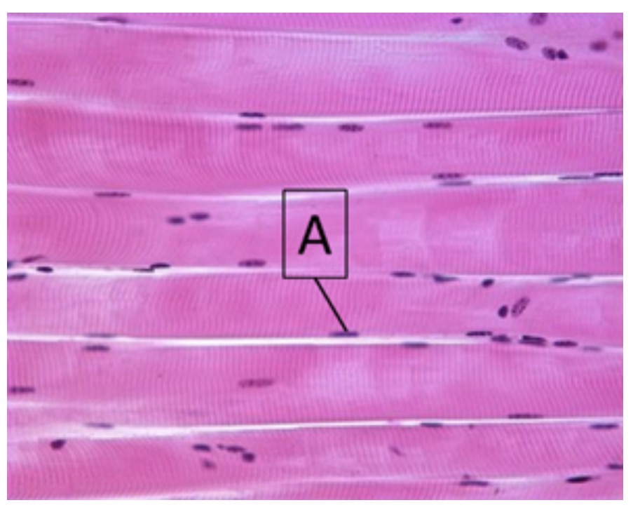 <p>identify this muscle tissue</p>