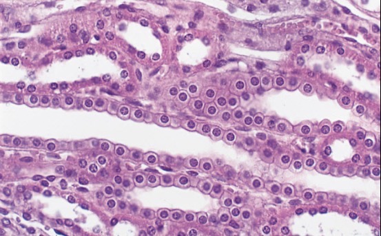<p>What is the type tissue in this image?</p>