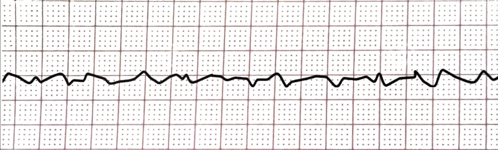 <p>What rhythm is this + bpm</p>
