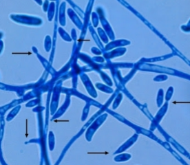 <p>Banana shaped microconidia</p>
