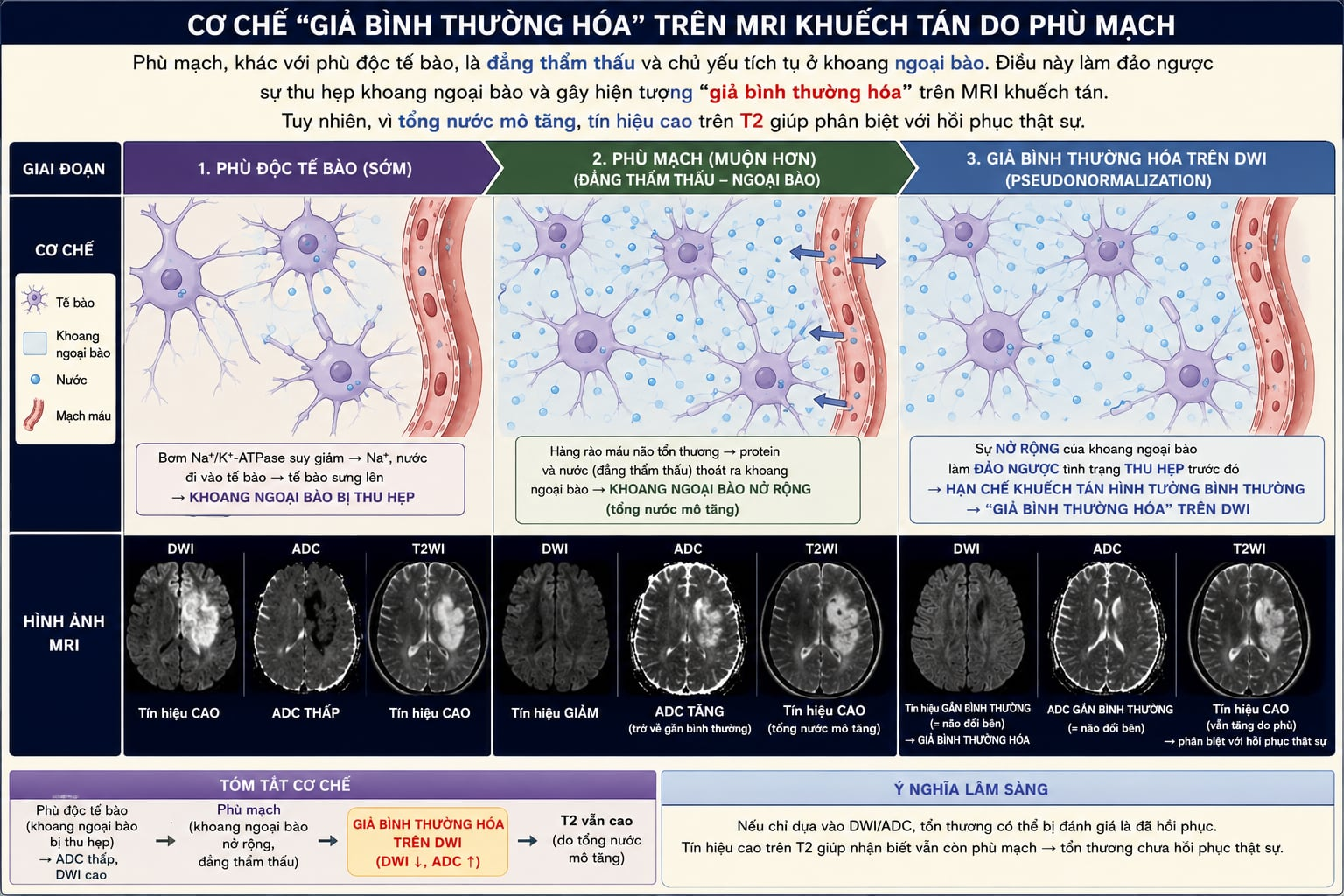 <p><span style="color: red;">A. Hiện tượng giả bình thường hóa</span></p><p>DWI/ADC: bình thường, T2 giúp xác nhận có hoàn toàn hồi phục hay chưa ?</p><p>Nếu DWI tín vừa, T2 cao: vẫn chưa hồi phục hoàn toàn</p>