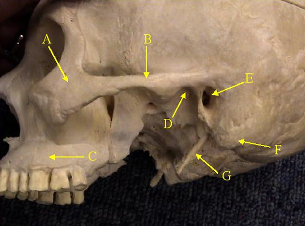 <p>Identify F and name the bone it is part of.</p>