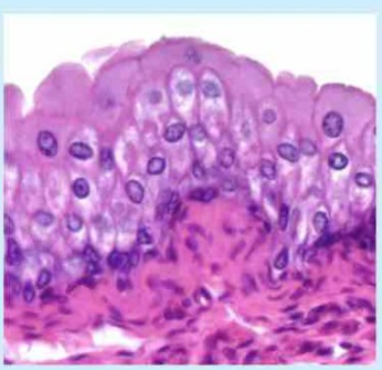 <p>Protection; stretching to accommodate distension of urinary structures, lines the ureter, urinary bladder and urethra </p>