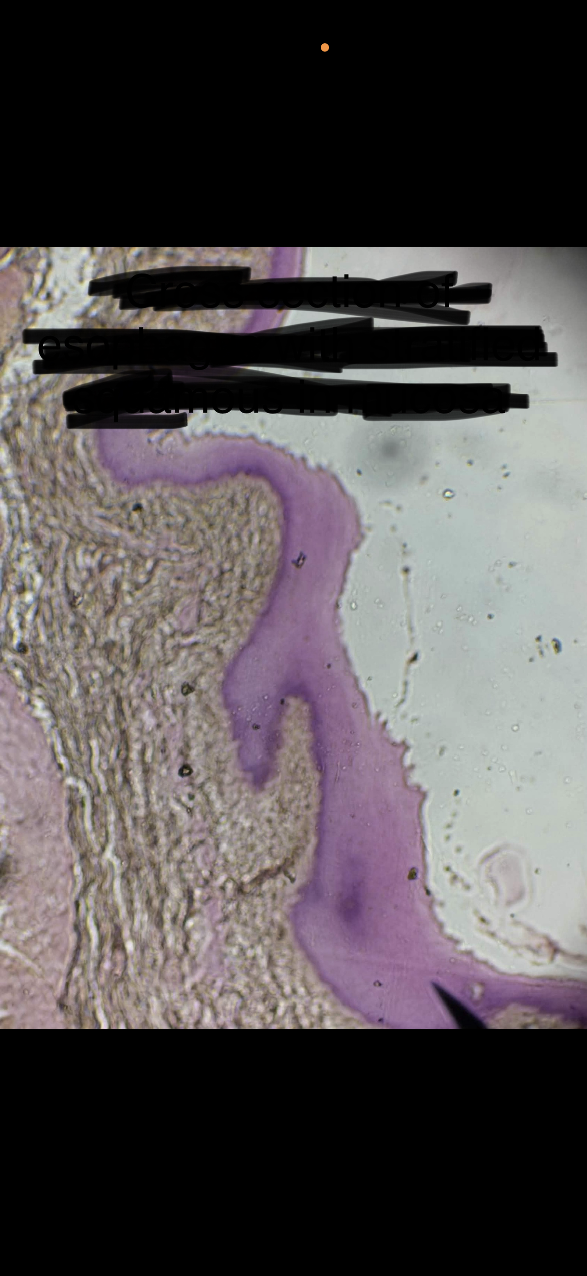 term image