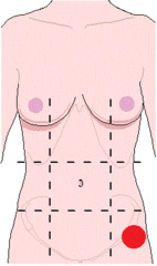 <p>identify the region of the abdomen:</p>