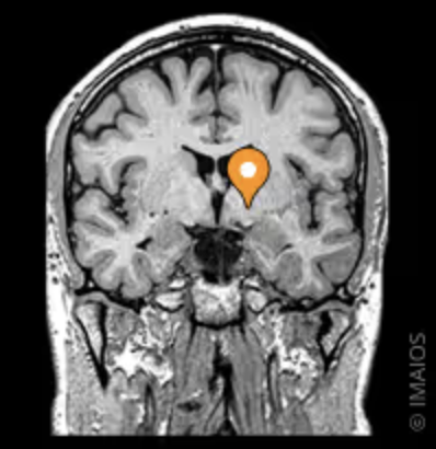 <p>Name this part of the brain</p>