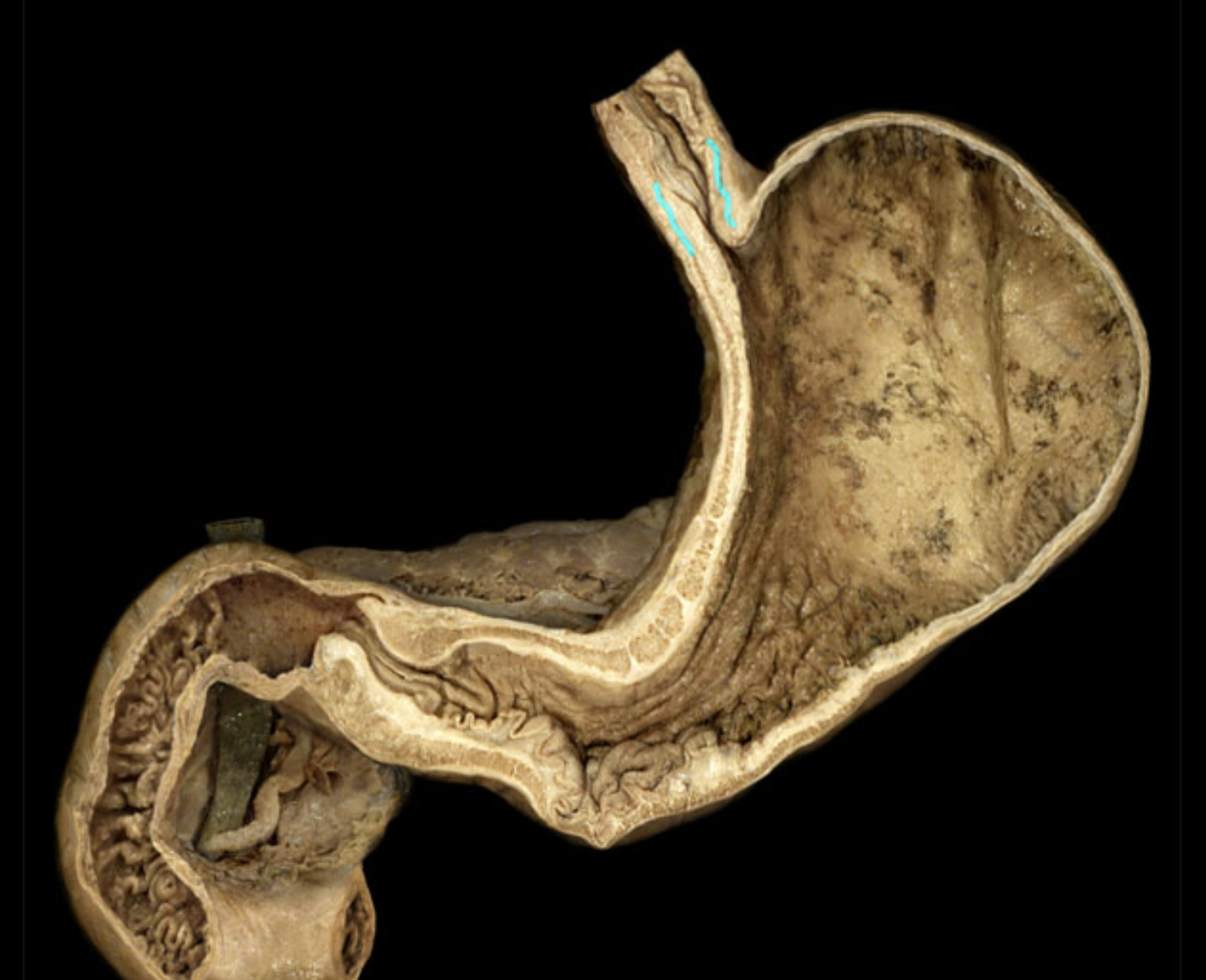 term image