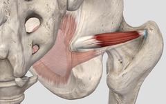 <p>greater trochanter of femur</p>