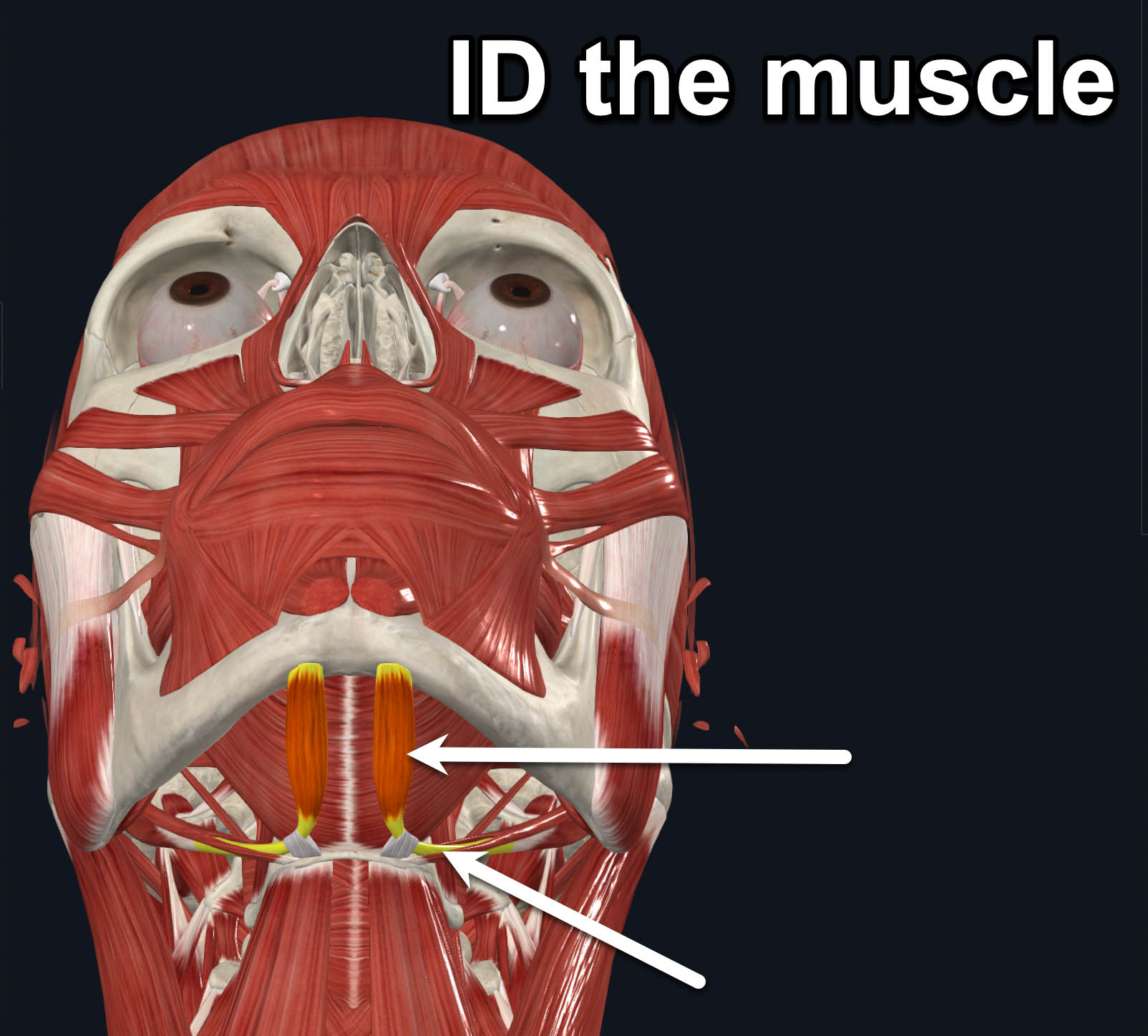 term image