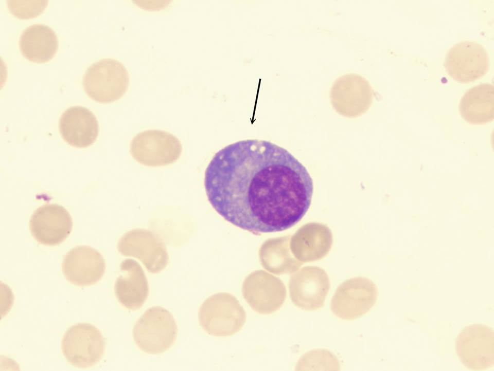 <p>Plasma cell morphology</p>