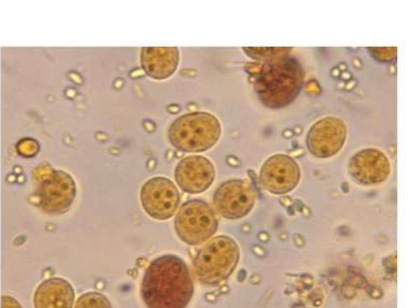 <p><span>9&nbsp;<strong>µm</strong></span></p>