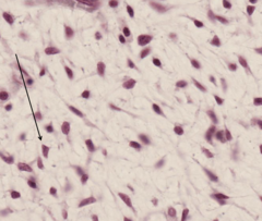 <p>Identify the mesenchymal cell at the arrow.</p>