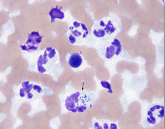 <p>This is from a horse joint. Describe what you see</p><p>1. inflammatory or noninflammatory?</p><p>2. cells?</p>